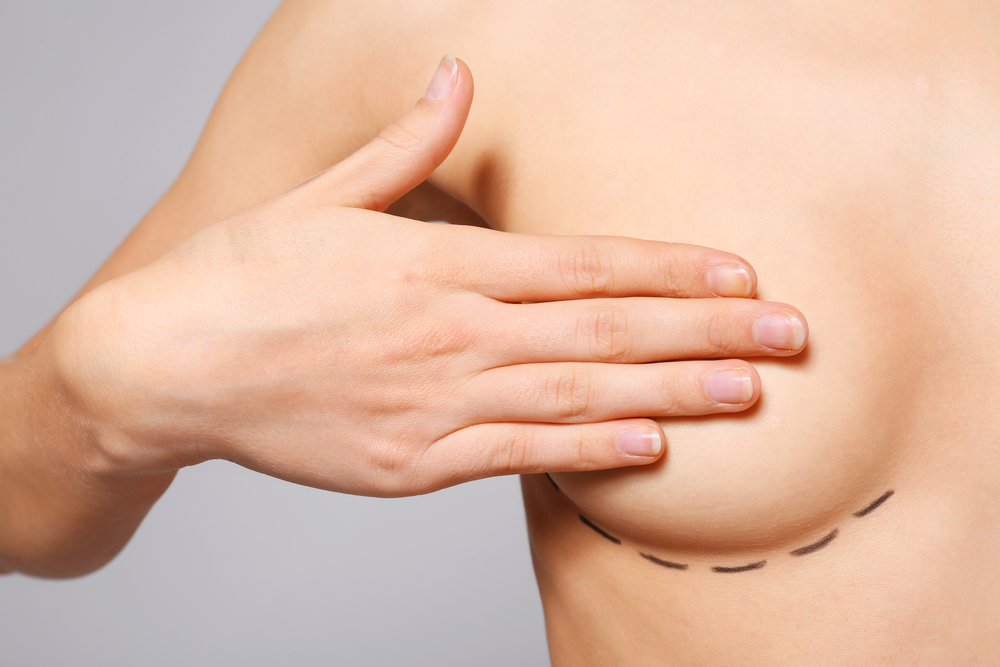 лактация после установки грудных  имплантов
