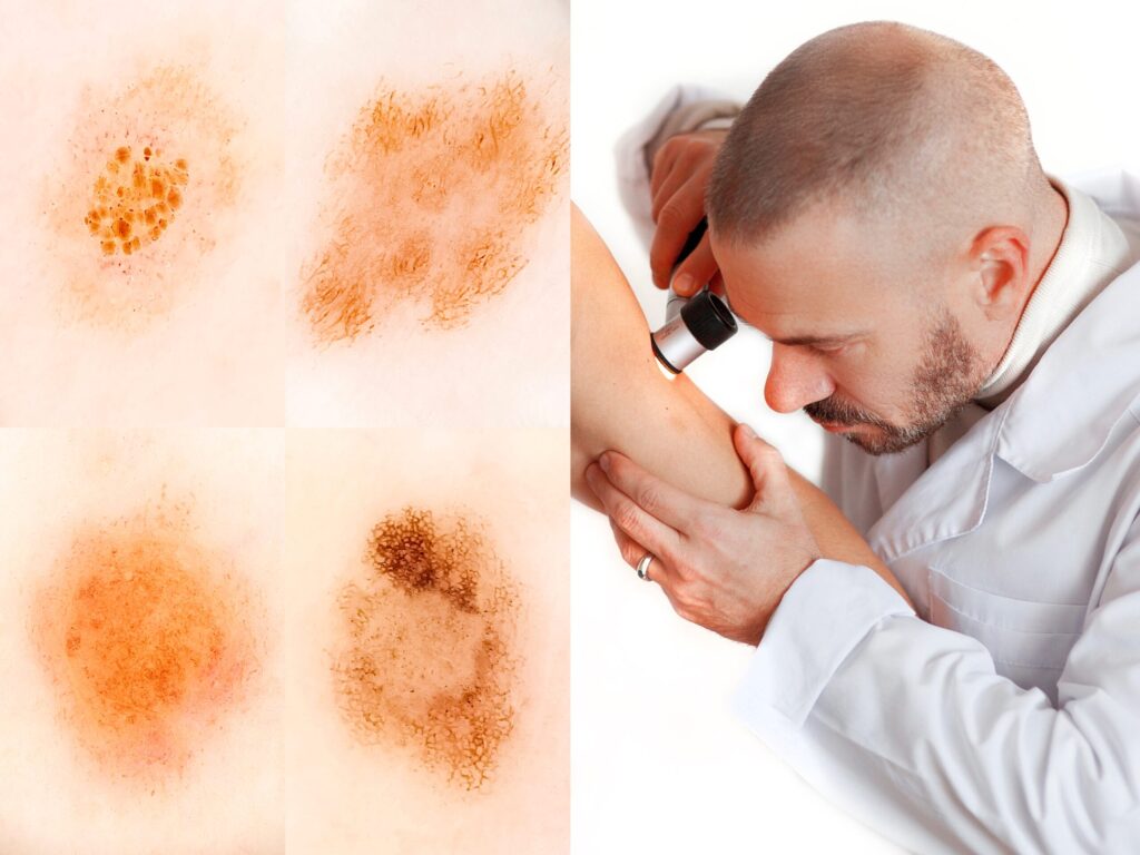 дерматоскопия